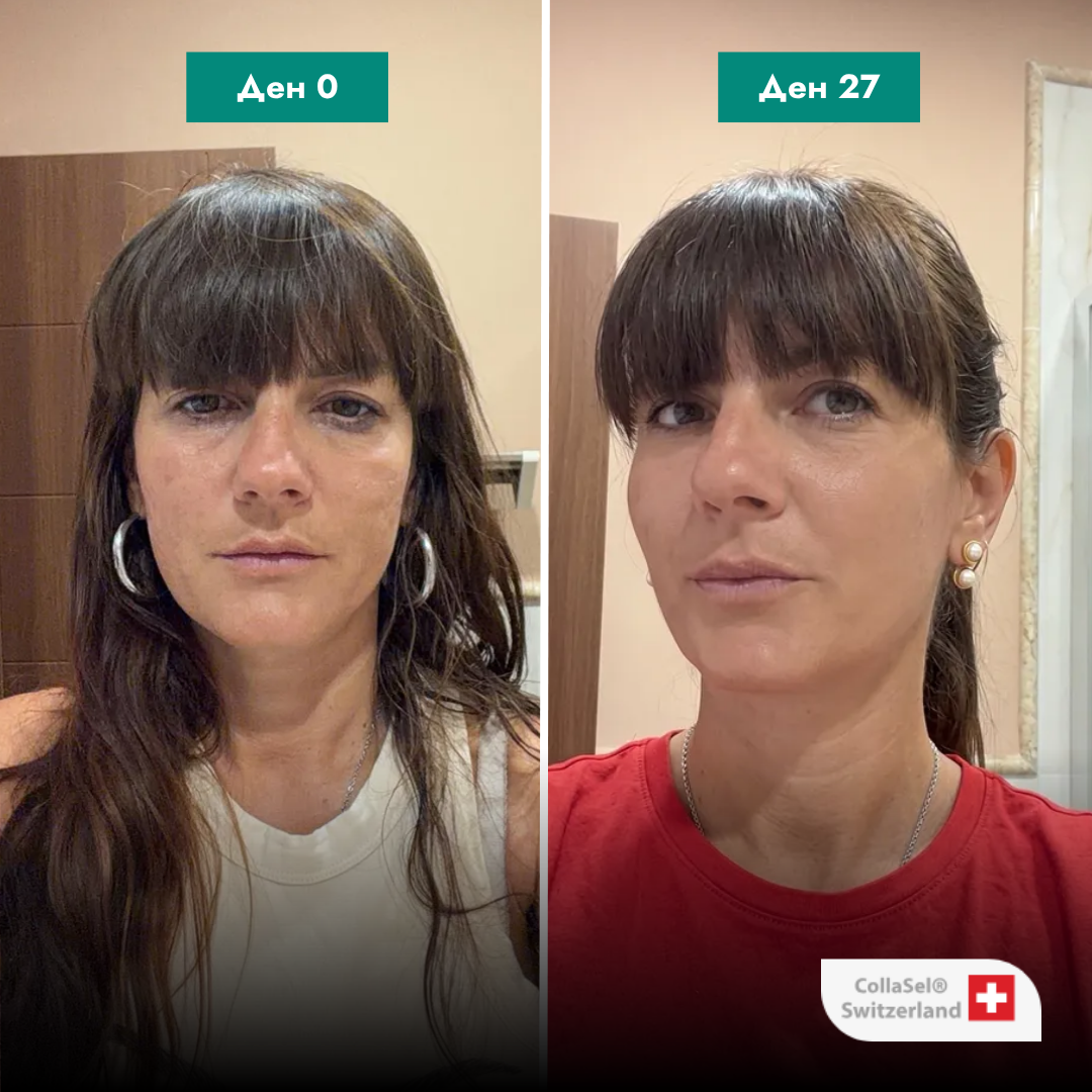 Flexrenew Forte Колаген